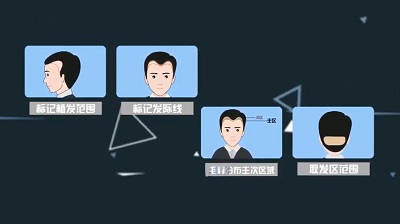 植发一平方厘米大概多少钱